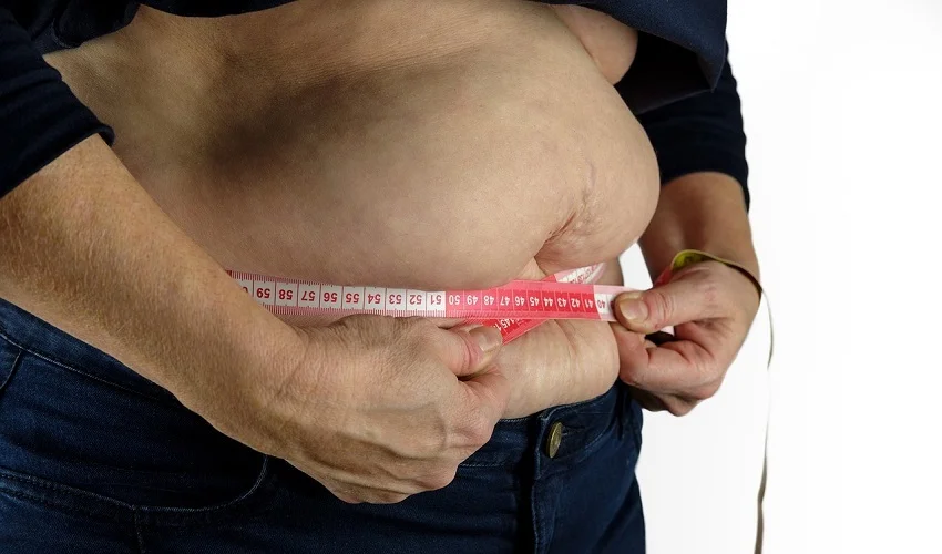 Truncal Obesity in Diabetes