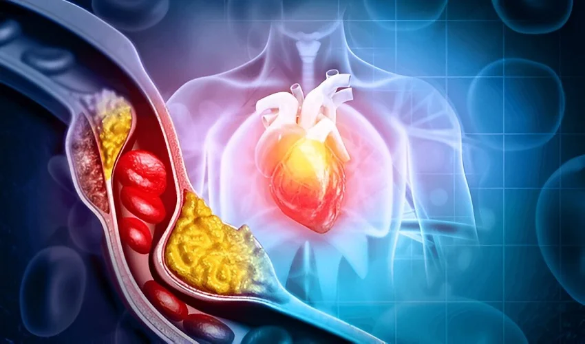 Cholesterol Medicine for Diabetics